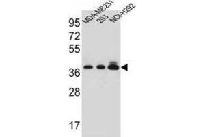 Western Blotting (WB) image for anti-Taste Receptor, Type 2, Member 1 (TAS2R1) antibody (ABIN2997059) (TAS2R1 anticorps)