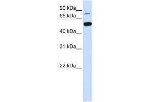 SMARCD1 antibody used at 1 ug/ml to detect target protein. (SMARCD1 anticorps  (Middle Region))