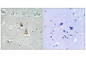 Immunohistochemistry (IHC) image for anti-Neutrophil Cytosol Factor 1 (NCF1) (Ser345) antibody (ABIN1848360) (NCF1 anticorps  (Ser345))