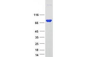 Ezrin (EZR) (Transcript Variant 2) protein (Myc-DYKDDDDK Tag)
