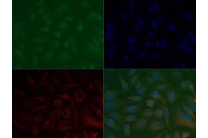 Immunofluorescence of Anti-Histone H3 K37 me3: Histone H3 trimethyl Lys37 antibody was tested at 1:100,000 in HeLa cells with FITC (green). (Histone 3 anticorps  (3meLys37))