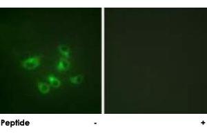 Immunofluorescence analysis of HepG2 cells, using TPH1 polyclonal antibody . (Tryptophan Hydroxylase 1 anticorps  (AA 25-75))
