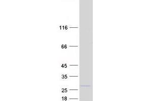 Validation with Western Blot