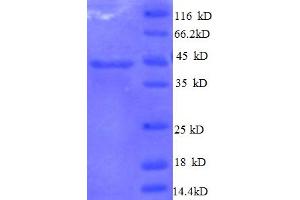 SDS-PAGE (SDS) image for Interleukin 10 (IL10) (AA 19-178) protein (GST tag) (ABIN5712490) (IL-10 Protein (AA 19-178) (GST tag))