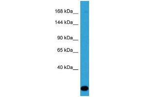 Host: Rabbit Target Name: ZC3H13 Sample Type: Jurkat Whole Cell lysates Antibody Dilution: 1. (ZC3H13 anticorps  (C-Term))