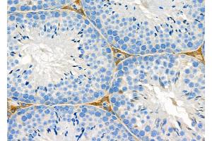 ABIN6263482 and ABIN6279565 at 1/100 staining Mouse testis tissue by IHC-P. (MYO5C anticorps  (Internal Region))
