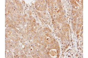 IHC-P Image Immunohistochemical analysis of paraffin-embedded N87 xenograft, using PDE9A, antibody at 1:500 dilution. (PDE9A anticorps  (N-Term))
