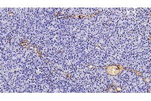 Detection of COL1a1 in Human Pancreas Tissue using Monoclonal Antibody to Collagen Type I Alpha 1 (COL1a1)