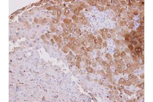 IHC-P Image HSD3B2 antibody detects HSD3B2 protein at cytosol on human normal liver by immunohistochemical analysis. (HSD3B2 anticorps)