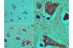 Image no. 1 for anti-T Brachyury Protein (AA 350-400) antibody (ABIN960367)