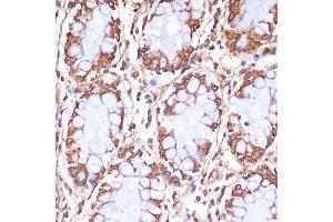 Immunohistochemistry of paraffin-embedded human colon using CPT1B antibody (ABIN6130130, ABIN6138978, ABIN6138979 and ABIN6222544) at dilution of 1:100 (40x lens).