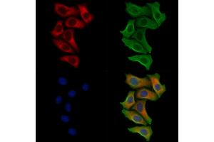 ABIN7093508 and ABIN7097532 staining Hela cells by IF/ICC.