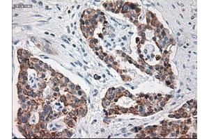 Image no. 6 for anti-Keratin 18 (KRT18) (AA 69-372) antibody (ABIN1491637)