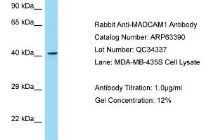 Western Blotting (WB) image for anti-Mucosal Vascular Addressin Cell Adhesion Molecule 1 (MADCAM1) (C-Term) antibody (ABIN2789480)
