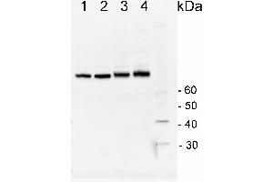 Image no. 2 for anti-Heat Shock Protein 70 (HSP70) (Cytoplasmic) antibody (ABIN334584) (HSP70 anticorps  (Cytoplasmic))