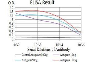 Black line: Control Antigen (100 ng),Purple line: Antigen (10 ng), Blue line: Antigen (50 ng), Red line:Antigen (100 ng)