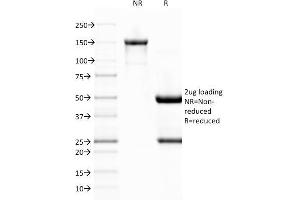 SDS-PAGE Analysis Purified vWF Monoclonal Antibody (VWF/1767).