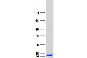 Validation with Western Blot