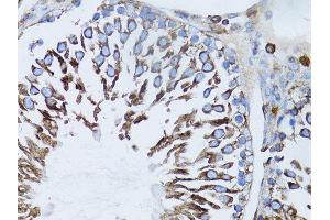 Immunohistochemistry of paraffin-embedded rat liver using β-actin antibody. (beta Actin anticorps)