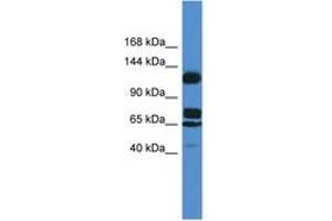 Image no. 1 for anti-Suppression of Tumorigenicity 5 (ST5) (AA 387-436) antibody (ABIN6746819) (ST5 anticorps  (AA 387-436))