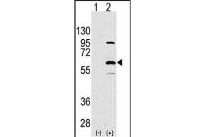 Western blot analysis of ELP3(arrow) using rabbit polyclonal ELP3 Antibody (N-term) (ABIN387966 and ABIN2844714). (ELP3/KAT9 anticorps  (N-Term))