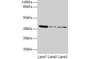 Western blot All lanes: MAS1 antibody at 2 μg/mL Lane 1: 293T whole cell lysate Lane 2: Colo320 whole cell lysate Lane 3: HepG2 whole cell lysate Secondary Goat polyclonal to rabbit IgG at 1/10000 dilution Predicted band size: 38 kDa Observed band size: 38 kDa (MAS1 anticorps  (AA 285-325))