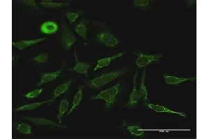 Immunofluorescence of purified MaxPab antibody to PDK4 on HeLa cell.