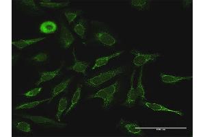 Immunofluorescence of purified MaxPab antibody to PDK4 on HeLa cell. (PDK4 anticorps  (AA 1-411))