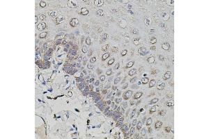 Immunohistochemistry of paraffin-embedded human esophagus using APP antibody (ABIN3020679, ABIN3020680, ABIN3020681 and ABIN6213663) at dilution of 1:100 (40x lens). (APP anticorps  (AA 190-290))