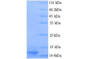 SDS-PAGE (SDS) image for Prothymosin, alpha (PTMA) (AA 2-112) protein (His tag) (ABIN5713766)