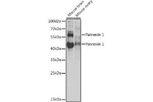 Western blot analysis of extracts of various cell lines, using Pannexin 1 antibody (ABIN6128523, ABIN6145204, ABIN6145206 and ABIN6217644) at 1:1000 dilution. (PANX1 anticorps  (AA 297-426))