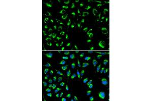 Immunofluorescence analysis of MCF-7 cells using PPP4C antibody. (PPP4C anticorps)