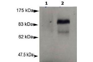 Detection of Prdm1 in murine plasmacytoma cell lysate (P3X) using Prdm1 monoclonal antibody, clone 3H2-E8 . (PRDM1 anticorps  (AA 199-409))