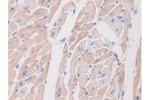 Detection of MST1R in Mouse Heart Tissue using Polyclonal Antibody to Macrophage Stimulating 1 Receptor (MST1R)