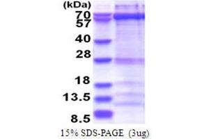 SDS-PAGE (SDS) image for Zwilch, Kinetochore Associated, Homolog (ZWILCH) (AA 1-591) protein (His tag) (ABIN5853741)