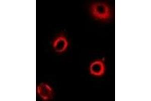 Immunofluorescent analysis of ArgRS staining in MCF7 cells. (ArgRS anticorps)