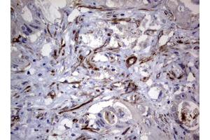 Image no. 9 for anti-Tuberous Sclerosis 1 (TSC1) (AA 836-1164) antibody (ABIN1491685)