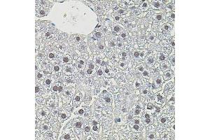 Immunohistochemistry of paraffin-embedded mouse liver using MYC antibody (ABIN4904459) at dilution of 1:100 (40x lens). (c-MYC anticorps)