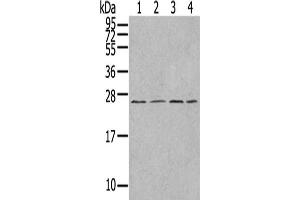 Gel: 12 % SDS-PAGE,Lysate: 40 μg,Lane 1-4: A549 cells, Jurkat cells, A375 cells, HepG2 cells,Primary antibody: ABIN7192977(UBTD1 Antibody) at dilution 1/300 dilution,Secondary antibody: Goat anti rabbit IgG at 1/8000 dilution,Exposure time: 1 minute (UBTD1 anticorps)