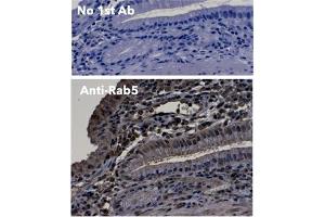 Immunohistochemistry (IHC) image for anti-RAB5A, Member RAS Oncogene Family (RAB5A) (C-Term) antibody (ABIN1440056)