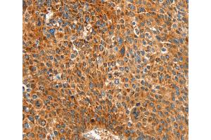 Immunohistochemistry (IHC) image for anti-Aldehyde Dehydrogenase 1 Family, Member A2 (ALDH1A2) antibody (ABIN2434082) (ALDH1A2 anticorps)