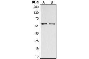 Western blot analysis of DOK2 (pY299) expression in A549 Insulin-treated (A), HepG2 (B) whole cell lysates.
