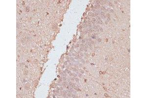 Immunohistochemistry of paraffin-embedded Rat brain using HSF1 Polyclonal Antibody at dilution of 1:100 (40x lens). (HSF1 anticorps)