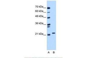 Image no. 1 for anti-RAB11B, Member RAS Oncogene Family (RAB11B) (C-Term) antibody (ABIN6738434) (RAB11B anticorps  (C-Term))