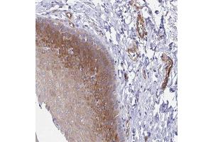 Immunohistochemical staining of human esophagus with KLC3 polyclonal antibody  shows moderate cytoplasmic positivity in squamous epithelial cells. (KLC3 anticorps)