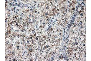 Immunohistochemistry (IHC) image for anti-Ribophorin 1 (RPN1) antibody (ABIN1500754)