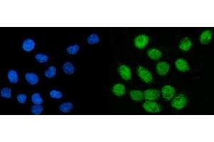IF analysis of CoREST/RCOR1 using anti-CoREST/RCOR1 antibody (ABIN7601035). (CoREST anticorps  (AA 270-485))