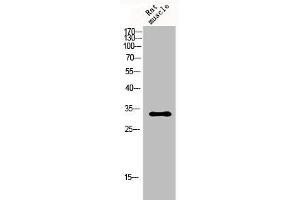 Western Blot analysis of rat-musle cells using p57 Polyclonal Antibody