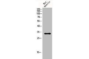Western Blot analysis of rat-musle cells using p57 Polyclonal Antibody (CDKN1C anticorps  (N-Term))