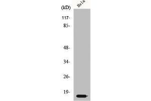 Western Blot analysis of HeLa cells using p14 Polyclonal Antibody (CDKN2A anticorps  (Internal Region))